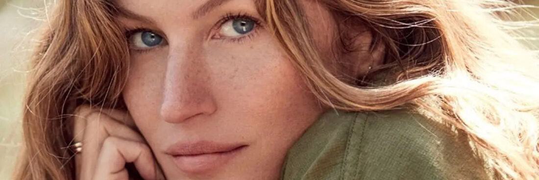 acne-entre-os-famosos