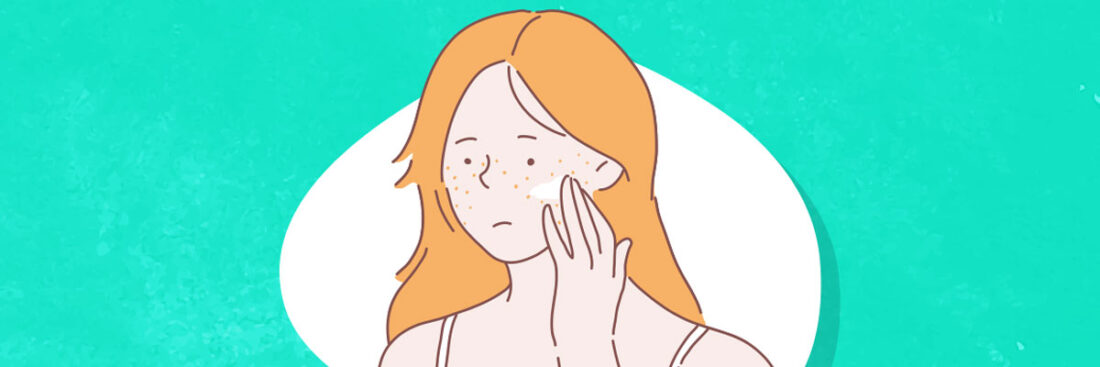 como-acabar-com-as-espinhas