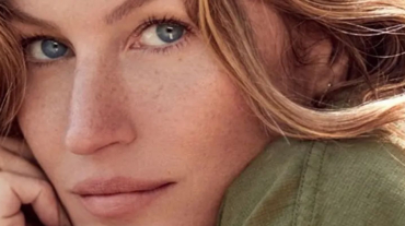 acne-entre-os-famosos