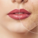 qual-o-melhor-tratamento-para-acne-na-adolescencia