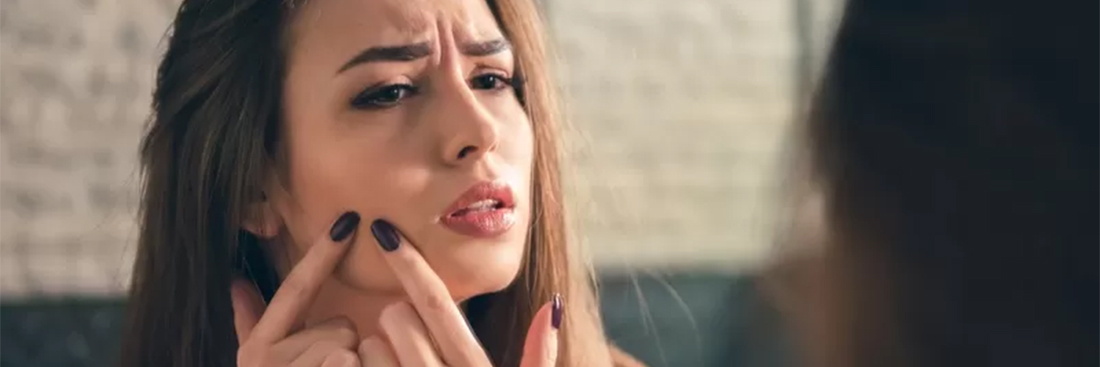 acne-por-estresse